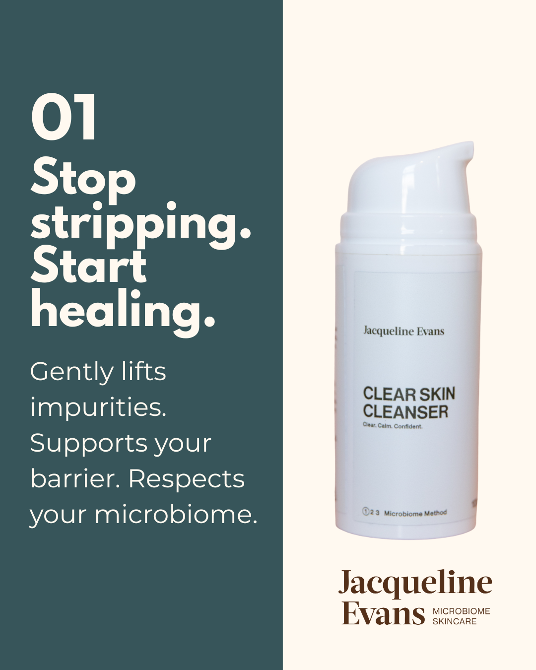 Why Most Acne Products Make Your Skin Worse (And What Works Instead)