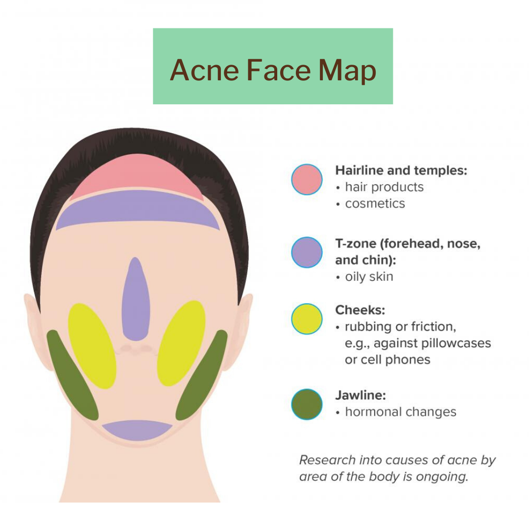 Mapping Rash Using face mapping to improve your skin's health – Jacqueline Evans ...