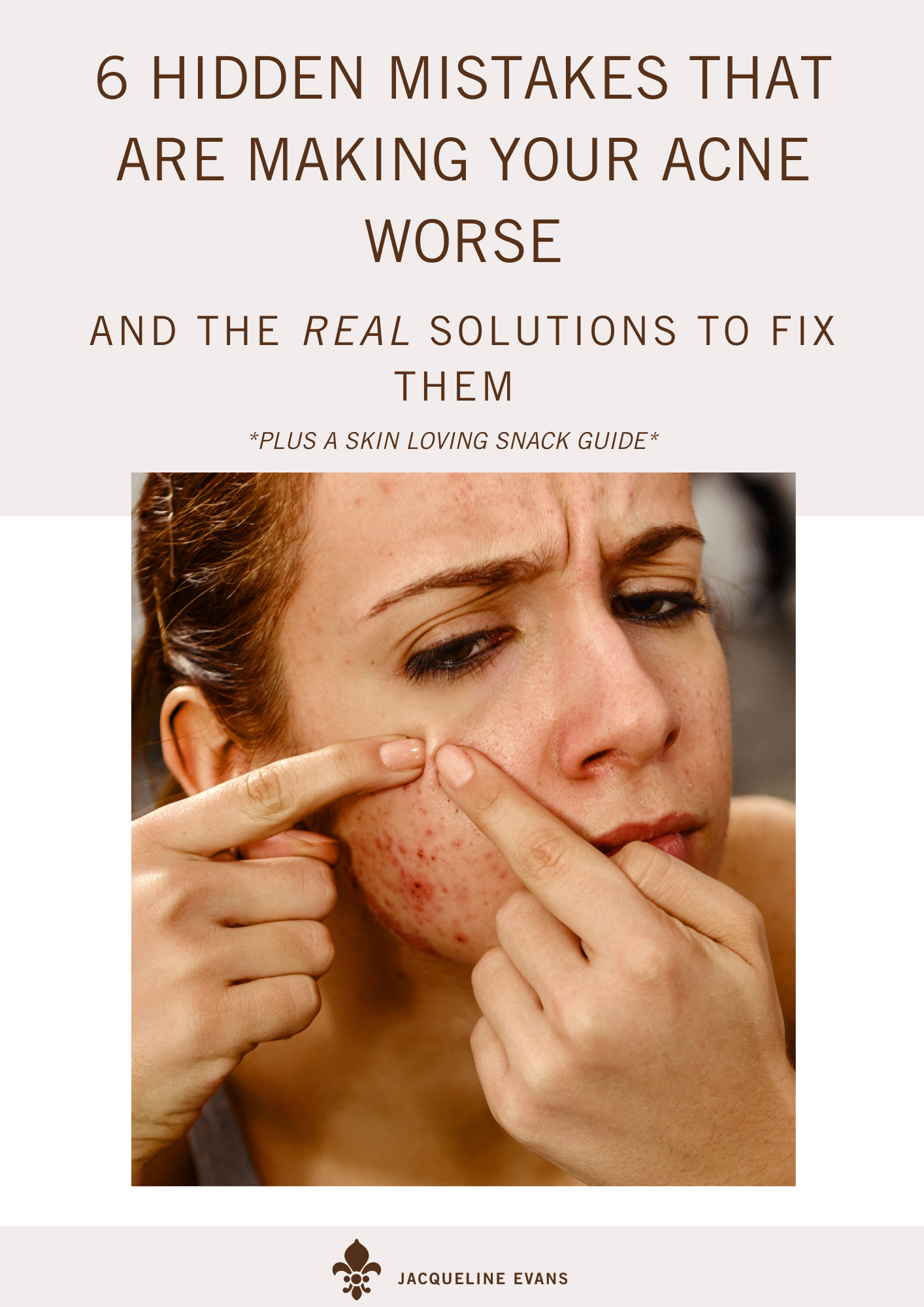 6 Hidden Mistakes Making Your Acne Worse
